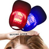Red & Infrared Light Therapy Cap | Hair Growth & Loss Treatment Device USB