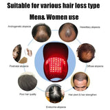 Red & Infrared Light Therapy Cap | Hair Growth & Loss Treatment Device USB