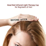 Red & Infrared Light Therapy Cap | Hair Growth & Loss Treatment Device USB