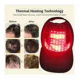 Red & Infrared Light Therapy Cap | Hair Growth & Loss Treatment Device USB